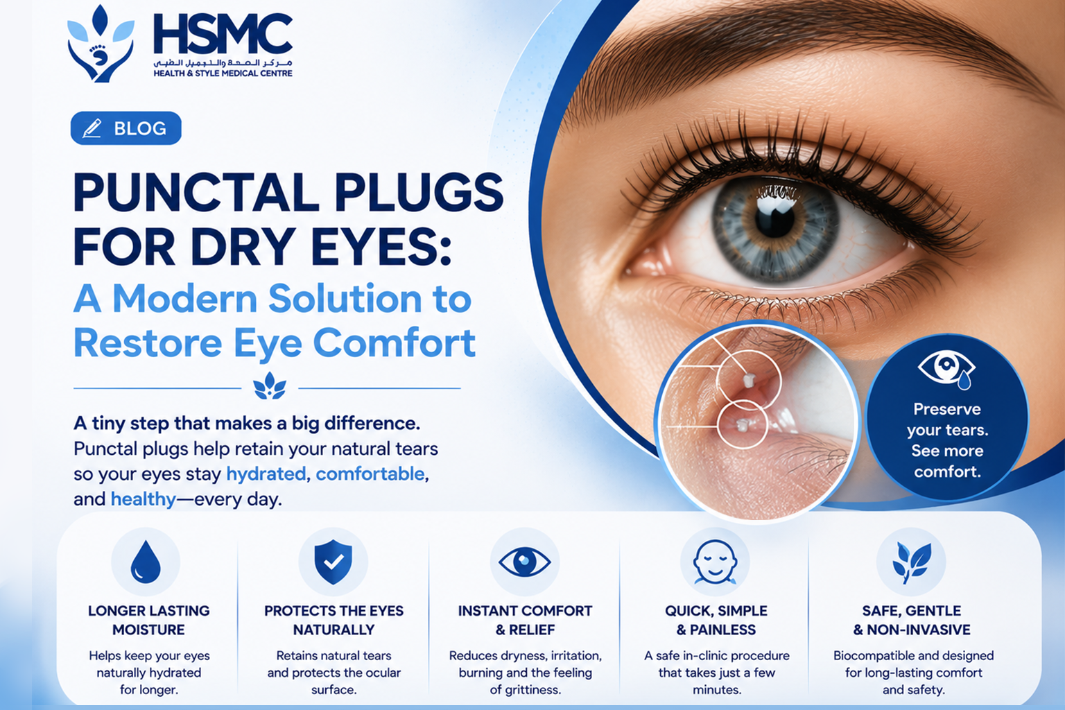 Punctal Plugs for Dry Eyes: A Modern Solution to Restore Eye Comfort